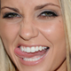 Illustration for article titled What is Americas Fetish This Week? emGreat White Teeth/em